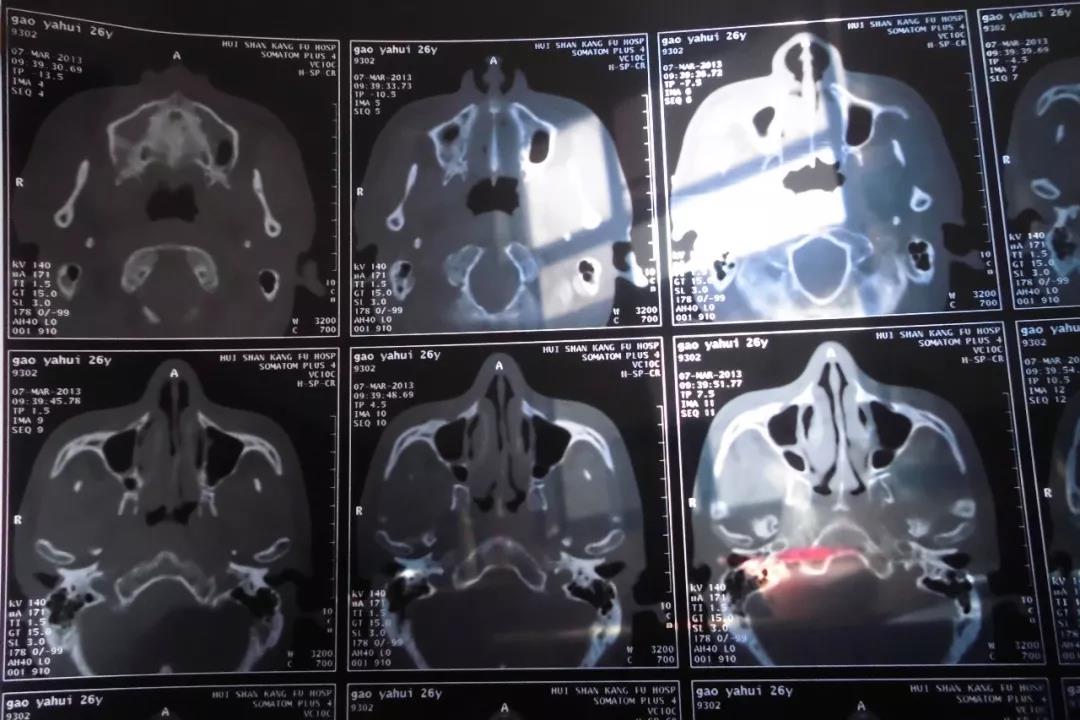 20200117/5e21296c22d60.jpg 11.jpg