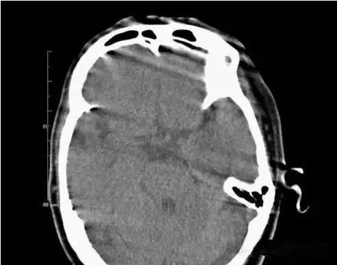 20200117/5e212b71149c9.png 23.png